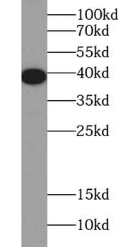A4GNT Rabbit Polyclonal Antibody