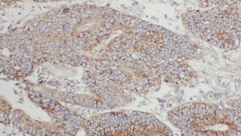 A4GNT Rabbit Polyclonal Antibody