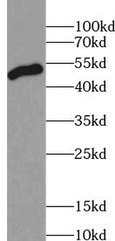 AAMP Rabbit Polyclonal Antibody