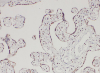 AAMP Rabbit Polyclonal Antibody