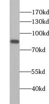 APEH Rabbit Polyclonal Antibody