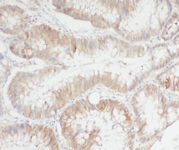 APEH Rabbit Polyclonal Antibody