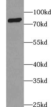 ABCD2 Rabbit Polyclonal Antibody