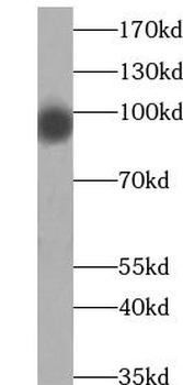 ABCF1 Rabbit Polyclonal Antibody