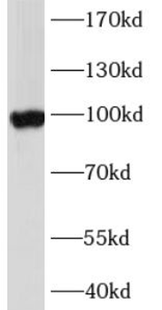 ABCG1 Rabbit Polyclonal Antibody