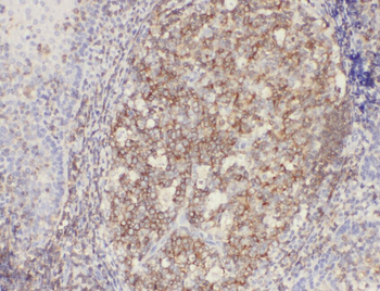 ABCG1 Rabbit Polyclonal Antibody