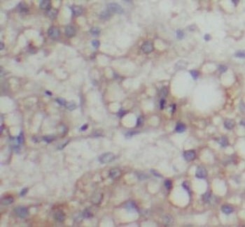 ABCG4 Rabbit Polyclonal Antibody