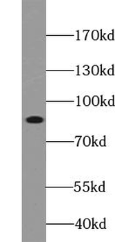ABLIM1 Rabbit Polyclonal Antibody