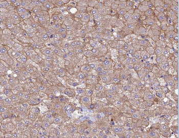 ABLIM1 Rabbit Polyclonal Antibody