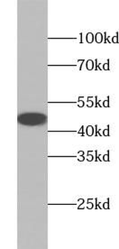ACADM Rabbit Polyclonal Antibody