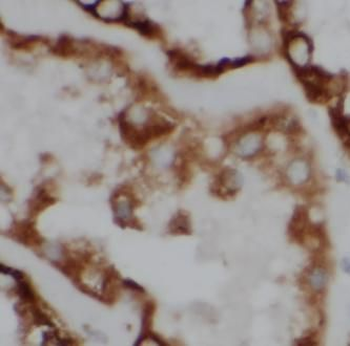 ACADM Rabbit Polyclonal Antibody