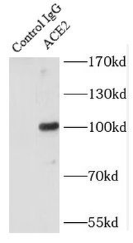 ACE2 Rabbit Polyclonal Antibody