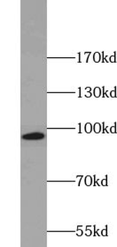 ACE2 Rabbit Polyclonal Antibody