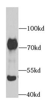 ACHE Rabbit Polyclonal Antibody