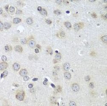 ACHE Rabbit Polyclonal Antibody