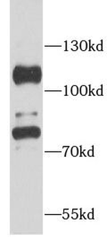 ACO1 Rabbit Polyclonal Antibody