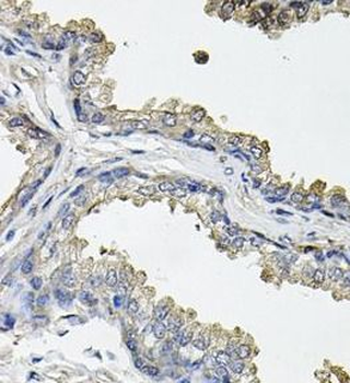 ACO1 Rabbit Polyclonal Antibody