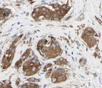 ACOT11 Rabbit Polyclonal Antibody