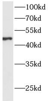 ACP6 Rabbit Polyclonal Antibody