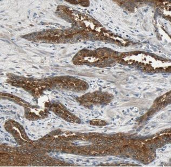 ACP6 Rabbit Polyclonal Antibody