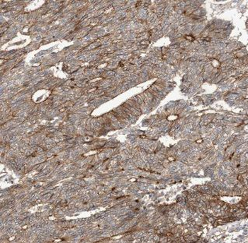 ACP3 Mouse Monoclonal Antibody
