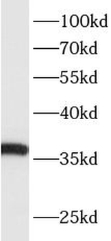 ACP4 Rabbit Polyclonal Antibody