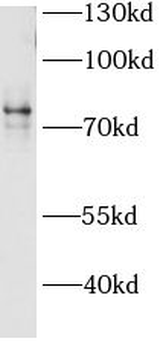 ACSL4 Rabbit Polyclonal Antibody