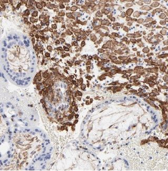 ACSL4 Rabbit Polyclonal Antibody