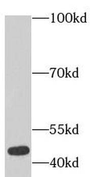 ACTA2 Rabbit Polyclonal Antibody