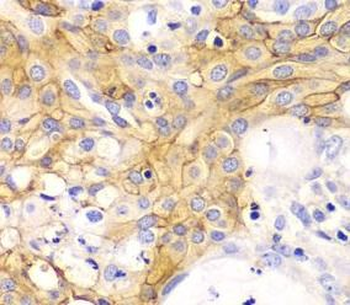 ACTA2 Rabbit Polyclonal Antibody