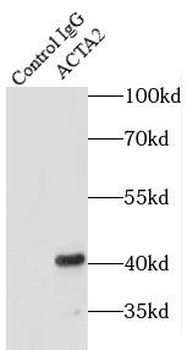 ACTA2 Rabbit Polyclonal Antibody