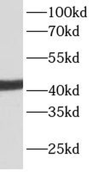 ACTA2 Rabbit Polyclonal Antibody