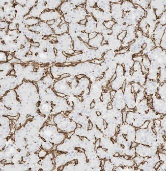 ACTA2 Rabbit Polyclonal Antibody