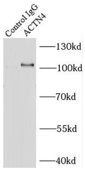 ACTN4 Rabbit Polyclonal Antibody