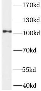 ACTN4 Rabbit Polyclonal Antibody