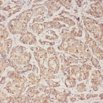 ACTN4 Rabbit Polyclonal Antibody