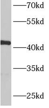 ACTR1B Rabbit Polyclonal Antibody