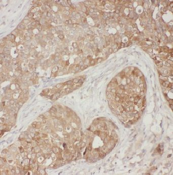 ACTR1B Rabbit Polyclonal Antibody