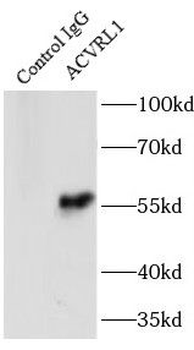 ACVRL1 Rabbit Polyclonal Antibody
