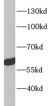 ACVRL1 Rabbit Polyclonal Antibody