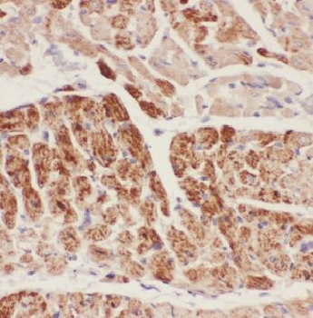 ACVRL1 Rabbit Polyclonal Antibody