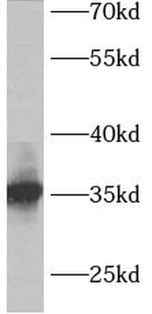 ACY3 Rabbit Polyclonal Antibody