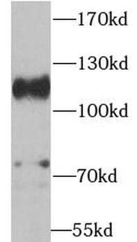 ADAM17 Rabbit Polyclonal Antibody