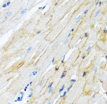 ADAM17 Rabbit Polyclonal Antibody