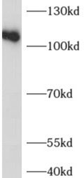 ADAR Rabbit Polyclonal Antibody