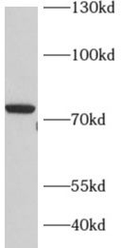 ADARB1 Rabbit Polyclonal Antibody