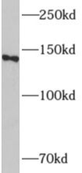 ADCY8 Rabbit Polyclonal Antibody