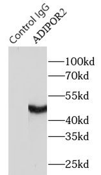 ADIPOR2 Rabbit Polyclonal Antibody