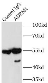 ADRM1 Rabbit Polyclonal Antibody