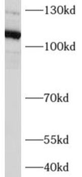 AFAP1L2 Rabbit Polyclonal Antibody